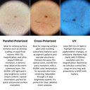 Illuco IDS 9100 Dematoscope 12x Optical Magnification