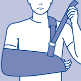 ACTIMOVE COMFORT ARM SLING X-LARGE 72819-64 EACH