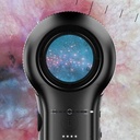 DERMLITE DL5 DERMATOSCOPE