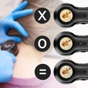 DERMLITE DL5 DERMATOSCOPE